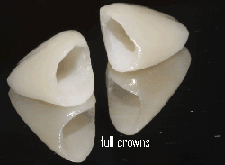 full dental crowns