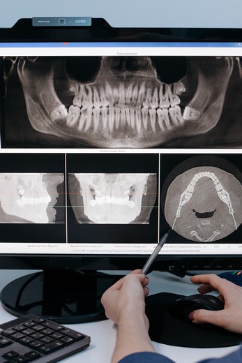 CT scan evaluation