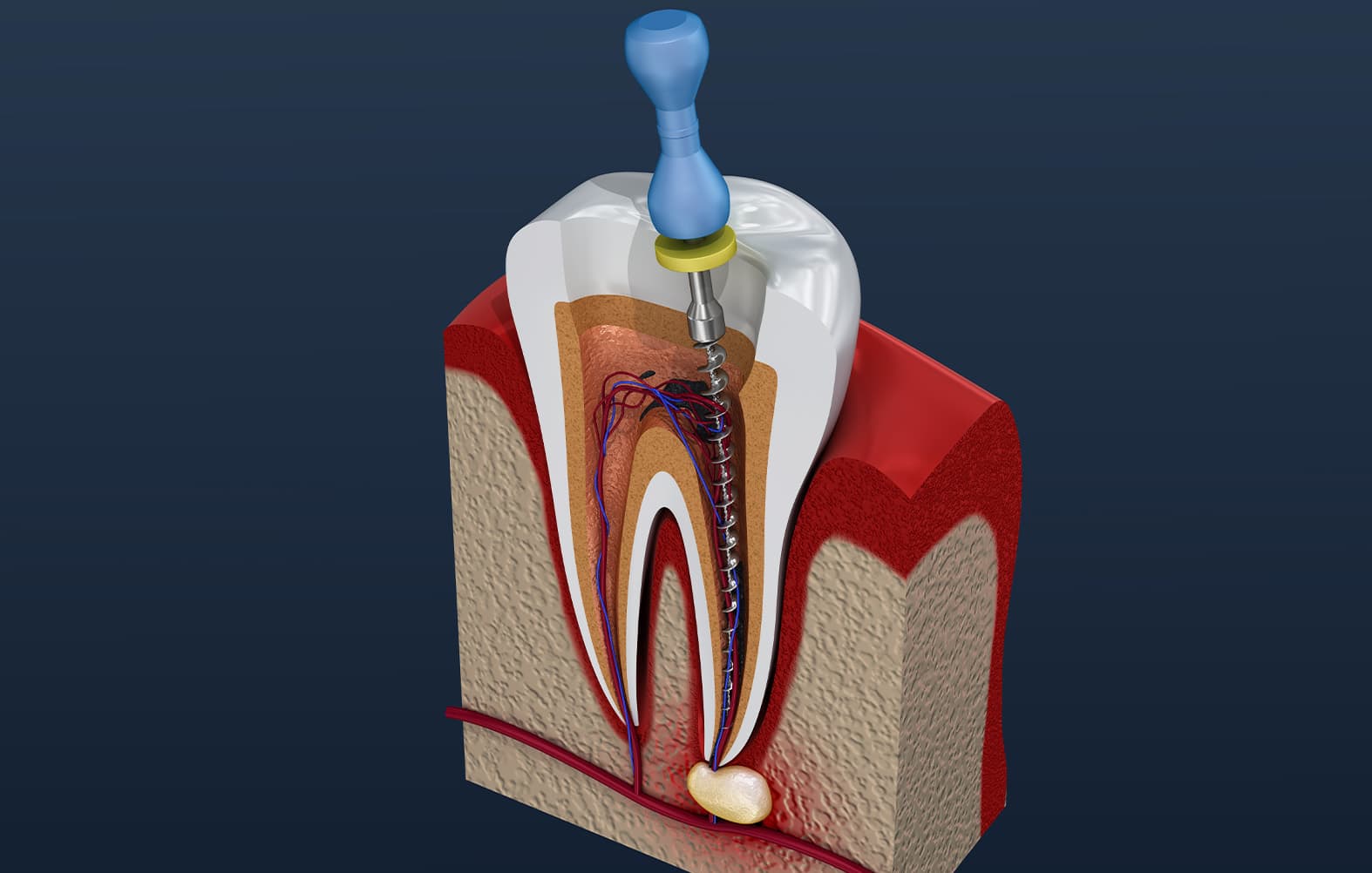 contents of the tooth root